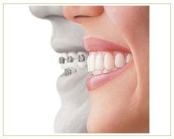 Slider image (8) PrimaDent Dental Center